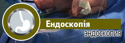 Ендоскопія Ендоскопія